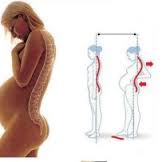 Pregnancy Posture